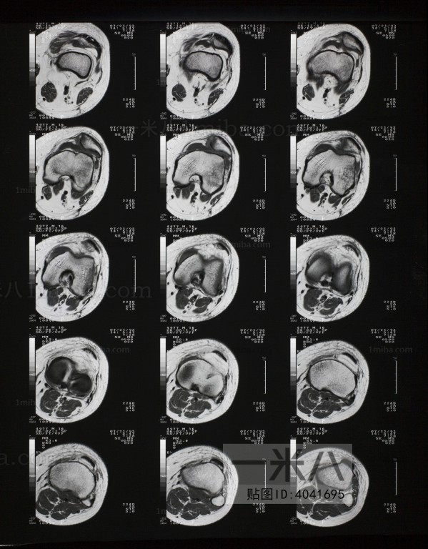 CT磁共振成像