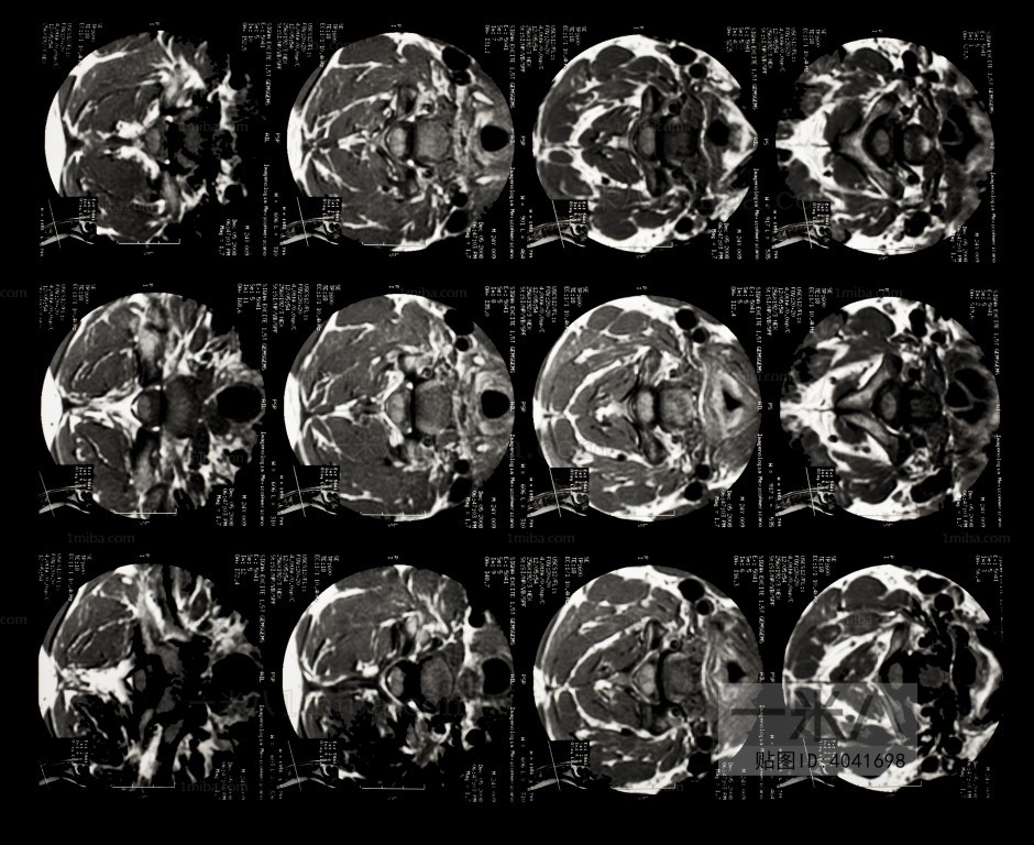 CT磁共振成像